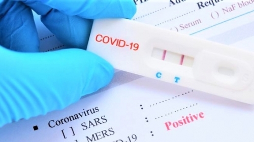 CDC Hà Nội không mua bộ kit test xét nghiệm Covid-19 của Công ty Việt Á